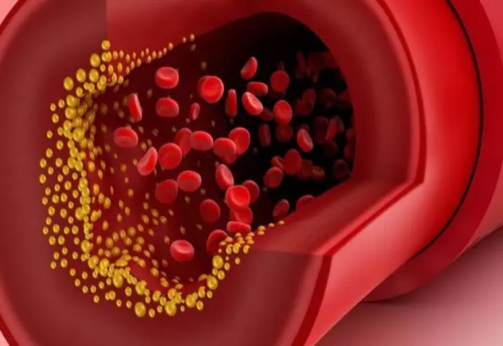 Cel mai periculos obicei alimentar care ne scurtează viața