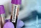 ULTIMA ORĂ Vrâncean confirmat cu infectare cu Coronavirus